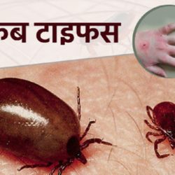 बैतडीमा १ महिनामा स्क्रब टाइफसका ४९ जना बिरामी फेला